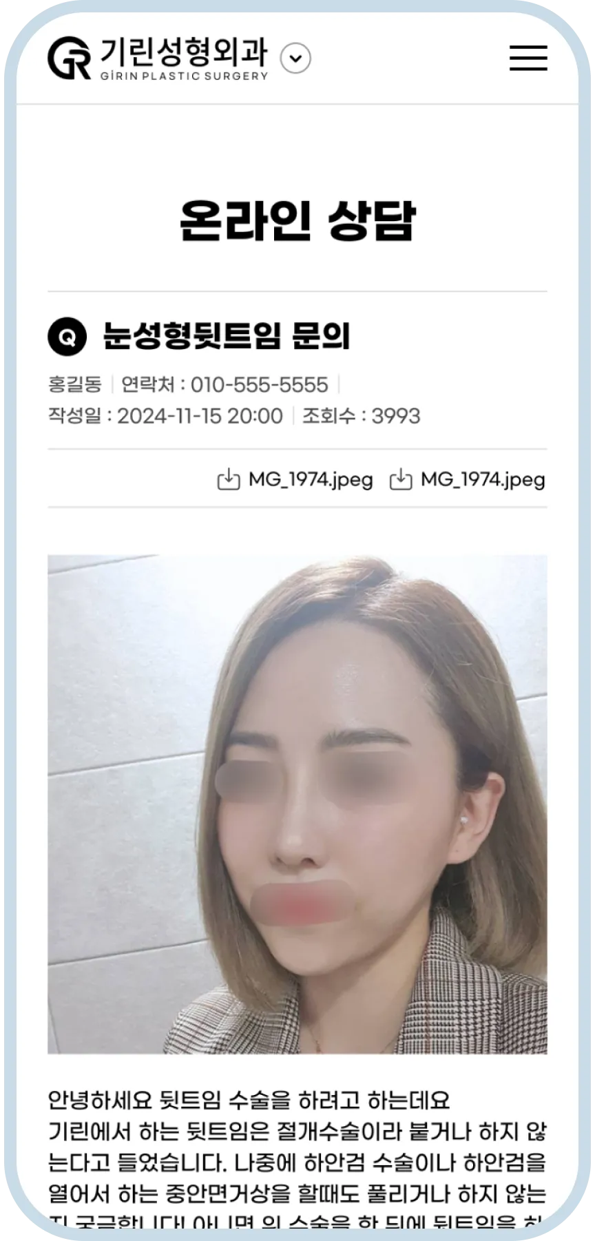 기린성형외과 모바일 온라인 상담 문의 화면